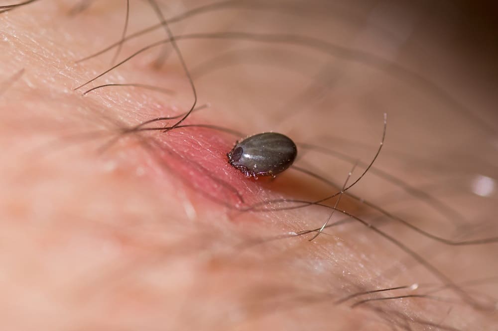 tick biting man's arm